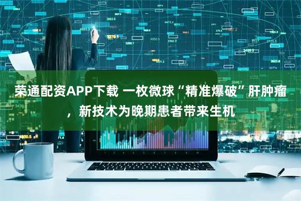 荣通配资APP下载 一枚微球“精准爆破”肝肿瘤，新技术为晚期患者带来生机